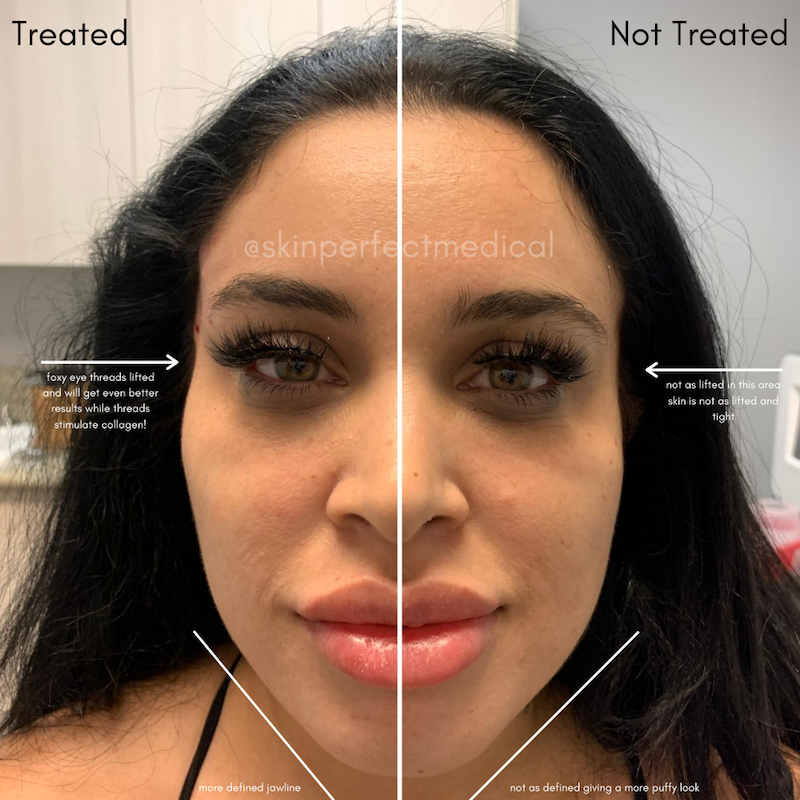 Glamorous Face Threading Thread Friendly For Skin 