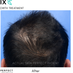 FoLix Before & After Patient #15026